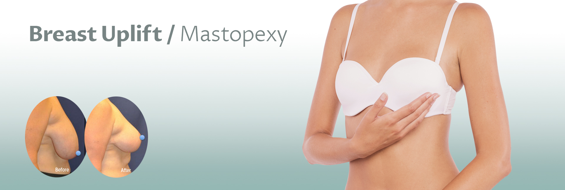 Breast Up Lift Surgery  Mastopexy or Breast Lift Cost London