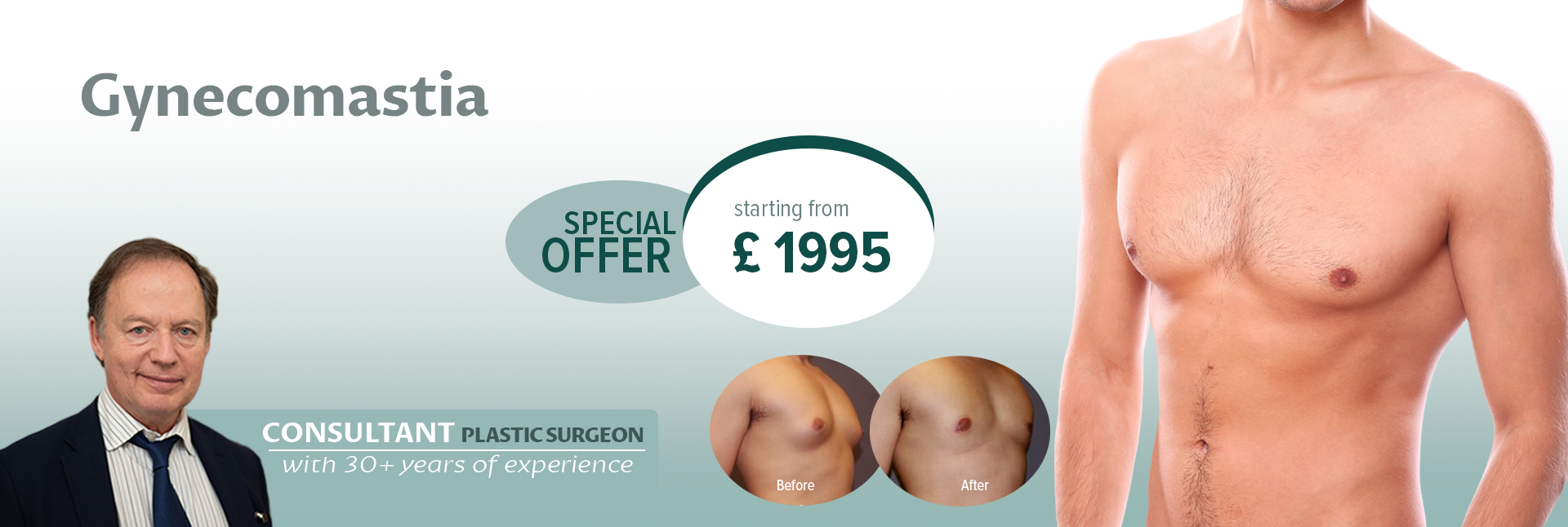 Gynecomastia Surgery London, Male Breast Reduction, Man Boobs